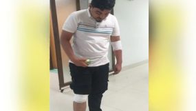 দূর্বৃত্তদের হামলায় এমসি কলেজ শিক্ষার্থী আবিদ আহত