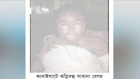 কানাইঘাটের অগ্নিদগ্ধ সাবানাকে বাঁচাতে সাহায্যের আবেদন || উন্নত চিকিৎসার জন্য ঢাকায় প্রেরন