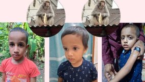 কানাইঘাটে বেড়েছে বানরের উপদ্রব || শিশুদের ওপর হামলায় আতঙ্ক