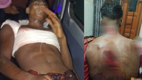 মৃত্যুর সাথে পাঞ্জা লড়ছে কানাইঘাটের গুরুতর আহত রুবেল || উল্টো মামলা দিয়ে হয়রানীর অভিযোগ