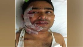 কানাইঘাটে ব্যবসায়ী আব্দুশ শহিদের উপর ফের হামলা, অন্তঃসত্ত্বা স্ত্রীসহ সন্তান আহত